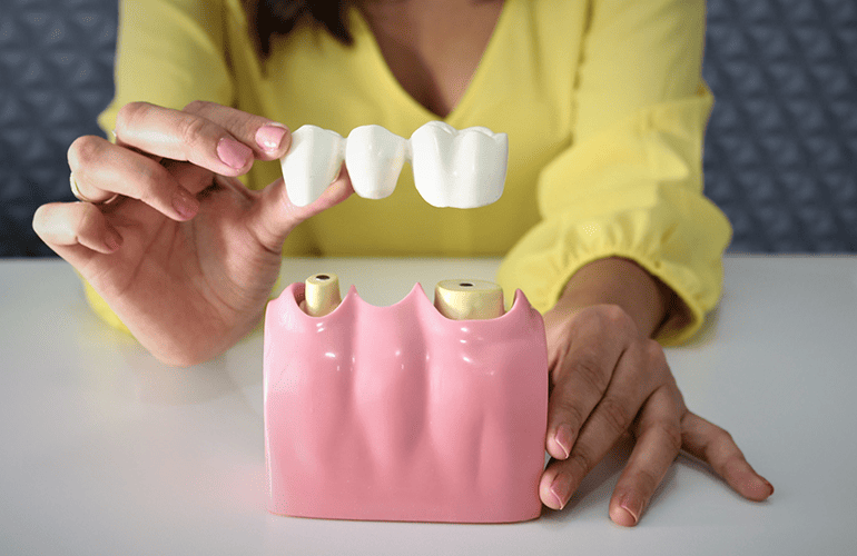 Prótese Dentária